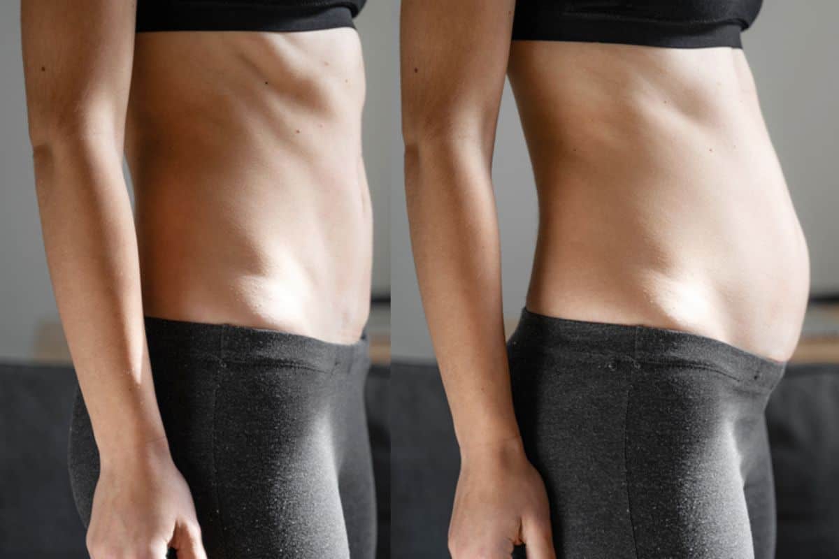 How long does diastasis recti take to improve Arundel?
