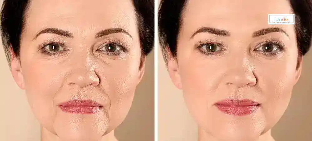 How Long Does It Take to See Results and How Long Do They Last Arundel?